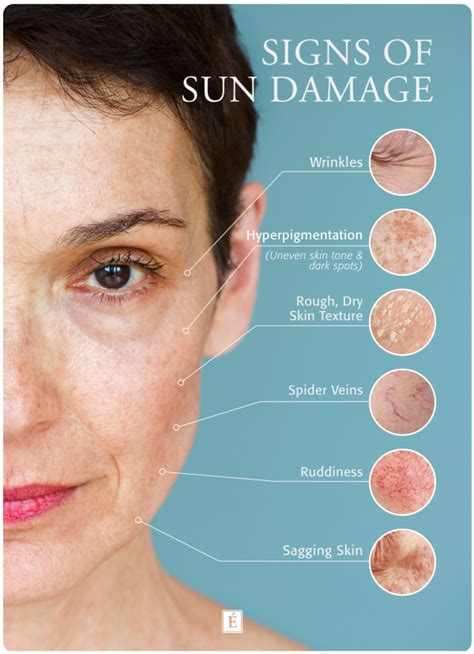 What Does Sun Damaged Skin Look Like