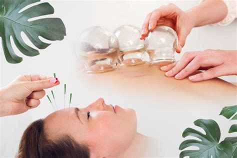 Acupuncture And Cupping What Is All The Hype About Edgemont Naturopathic Clinic