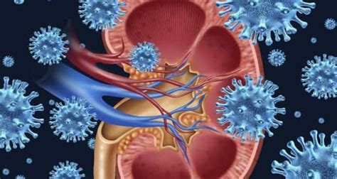 Pyelonephritis Or Kidney Infection Causes Symptoms Diagnosis