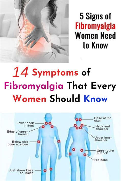 14 Symptoms Of Fibromyyalgia That Every Women Should Know