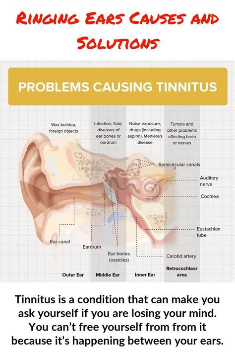 Tinnitus Is Most Notieceable When You Are On Your Own In What Would