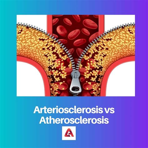 Difference Between Arteriosclerosis And Atherosclerosis