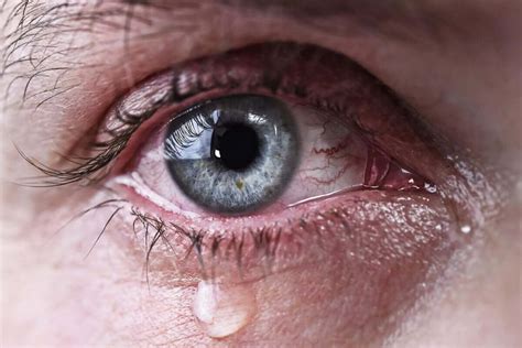 What Are The Causes Of Watery Eyes Step To Health