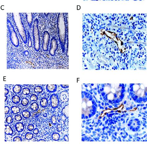 Immunohistology Of Venule Endothelial Expression Of Ccl21 In Intestinal