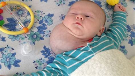 Baby Born With Two Heads Most Shocking Birth Youtube