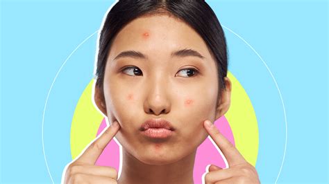 The 6 Types Of Pimples And What You Need To Get Rid Of Them