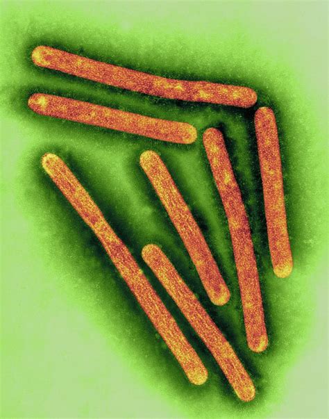 H5n1 Avian Influenza Virus Photograph By Dennis Kunkel Microscopy