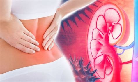 Back Pain Dull Ache And Pain Could Be Symptoms Of Kidney Disease