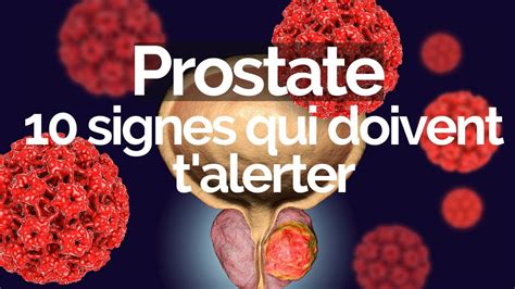 PROSTATE Signes Qui Doivent T Alerter YouTube