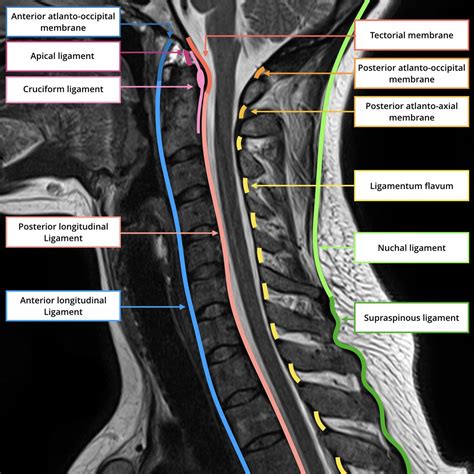 Mri Cervical Spine Anatomy Anatomy Diagram Source