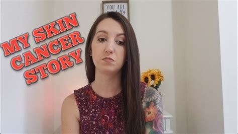 My Skin Cancer Story Tanning Beds Gave Me Cancer Erika Ann Youtube
