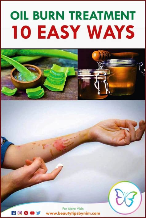 Oil Burn Treatment 10 Easy Ways To Treat It Beauty Tips By Nim