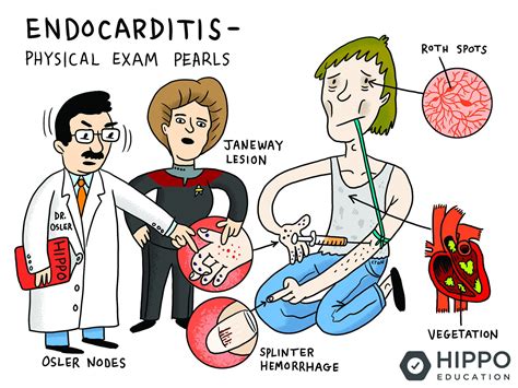 Infective Endocarditis Cartoon