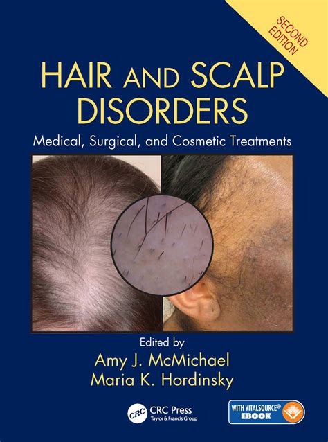 Hair And Scalp Disorders Taylor And Francis Group