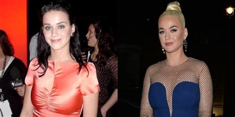 Katy Perry Denies Plastic Surgery Face Before And After