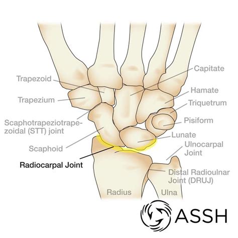 The radius is the bone which is present laterally, which means when your palm is facing upwards, it is away from. 29 best Hand, Wrist and Finger Topics and Conditions ...