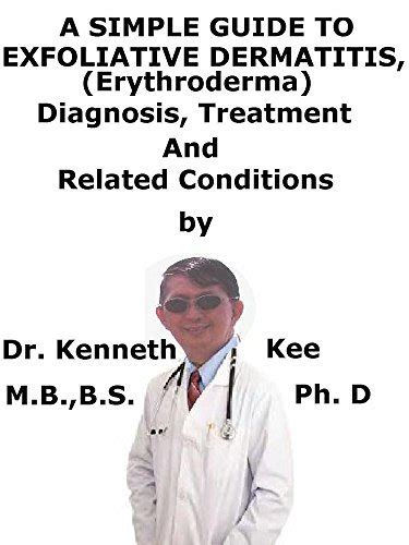 A Simple Guide To Exfoliative Dermatitis Erythroderma Diagnosis
