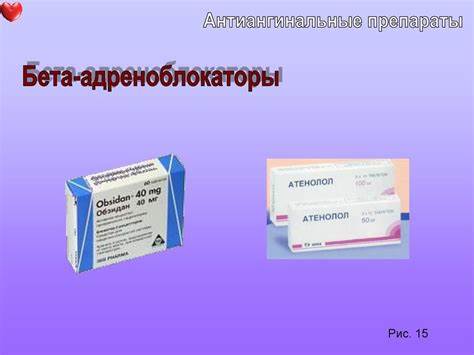СП при ИБС, стенокардии - online presentation Картинка - СП при ИБС, стенокардии - online presentation