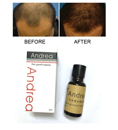 Steps to how to use andrea hair growth essence Andrea Hair Growth Essence Serum sem eykur hárvöxt, þykkir ...