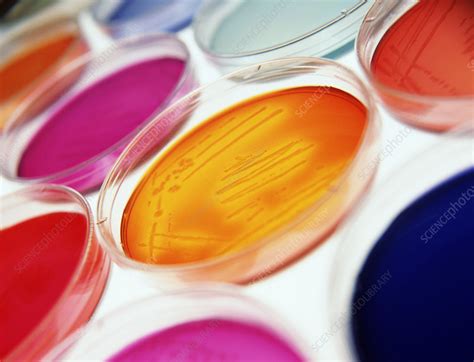 Petri Dishes Containing Bacterial Cultures Stock Image M Science Photo Library