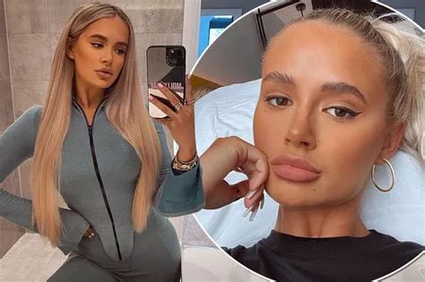 Molly Mae Hague Unveils Natural Lips For First Time As She Gets Fillers Removed Mirror Online