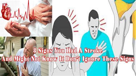 8 Signs You Had A Stroke And Might Not Know It Dont Ignore These Signs
