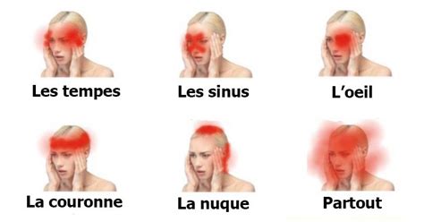 La seconde partie est donc une réponse à la première. Apprenez à reconnaître quels types de maux de tête sont ...