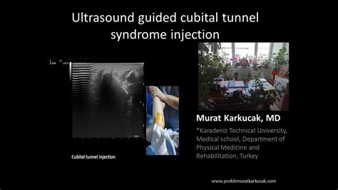 Ultrasound Guided Cubital Tunnel Syndrome Injection By Prof Murat