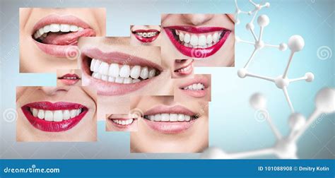 Collage Of Healthy Teeth With Big Molecule Chain Stock Photo Image