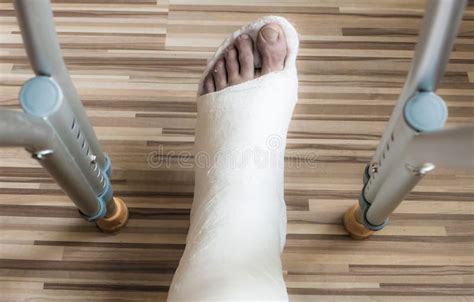 Broken Ankle And Crutches Stock Photo Image Of View 64448358