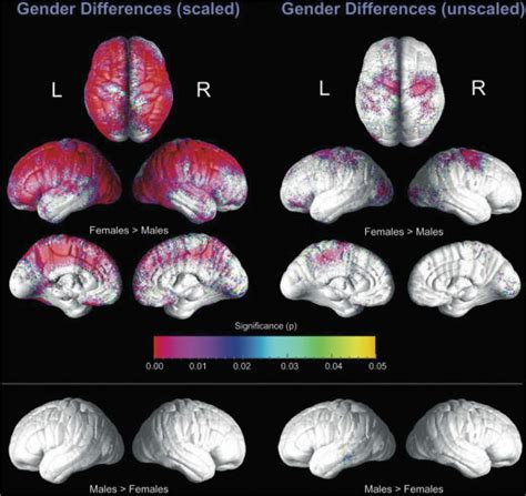 Sex On The Brain Are Gender‐dependent Structural And Functional