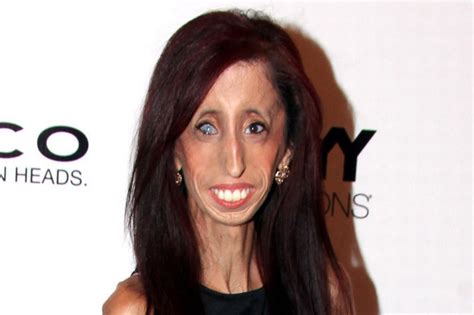 Lizzie Velasquez Woman Labelled Ugliest In The World By Online