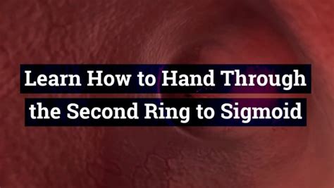 Learn How To Hand Through The Second Ring To Sigmoid Learn Anal Depth Fisting Skills Fast And