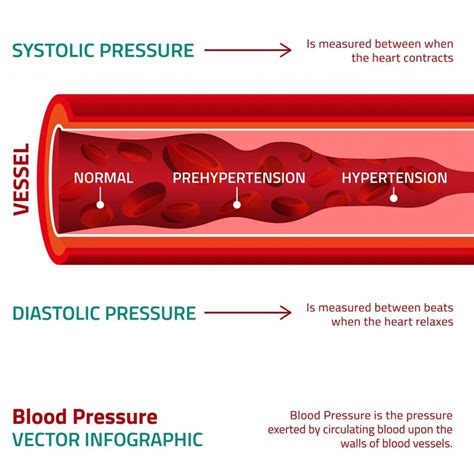 High Blood Pressure Hbp What It Means And Who Can Get It Lishe Living