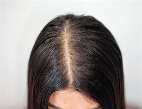 5 Simple Tips For Women Thinning Hair