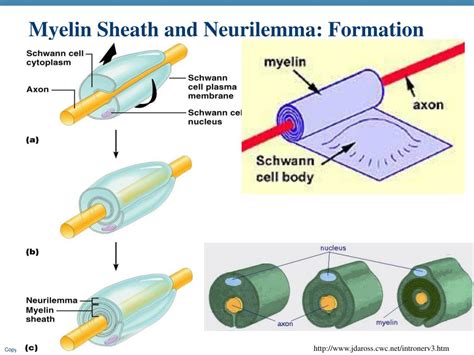 Myelin Sheath Destruction Inherited And Acquired Disorders Of Myelin