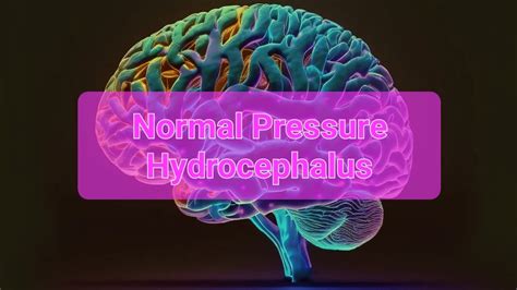 Normal Pressure Hydrocephalus Ppt YouTube