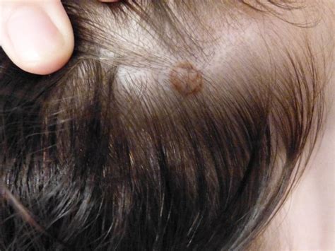 Sie sind unsicher und lassen jede beule lieber von einem arzt im krankenhaus. Komische Stelle auf der kopfhaut? (Gesundheit, Kopf)