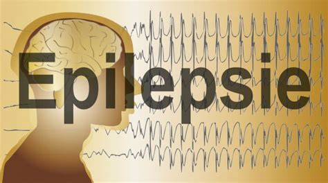 Epilepsie Symptomen