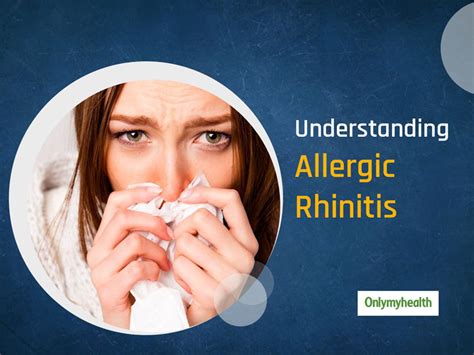What Is Allergic Rhinitis Know Symptoms Treatment To Manage This