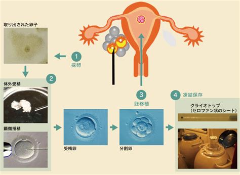 体外受精など高度生殖医療art 江東区亀戸の不妊症外来 五の橋レディスクリニック