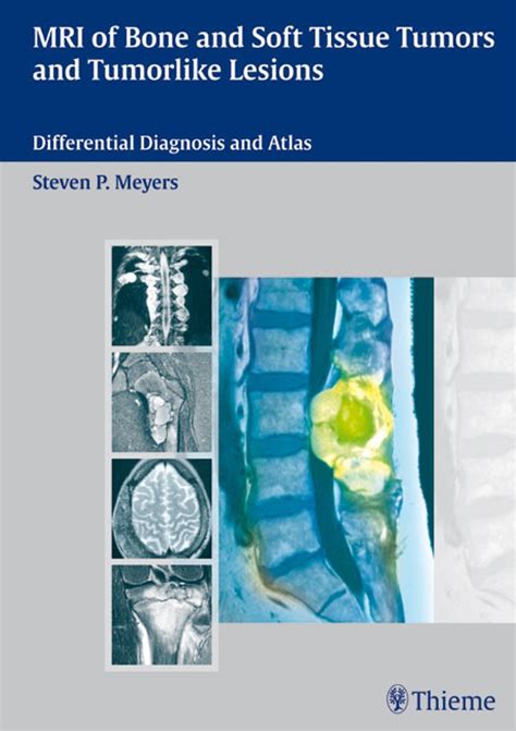 Mr Imagaging Of Bone And Soft Tissue Tumors Tumor Like Lesions Buch