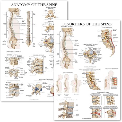 Palace Learning 2 Pack Anatomy Of The Spine Disorders Of The Spine