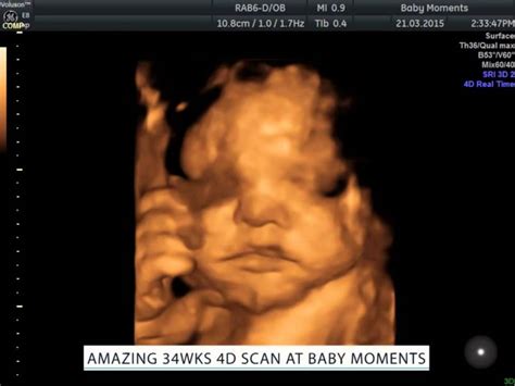 Amazing 4d Baby Scan Youtube