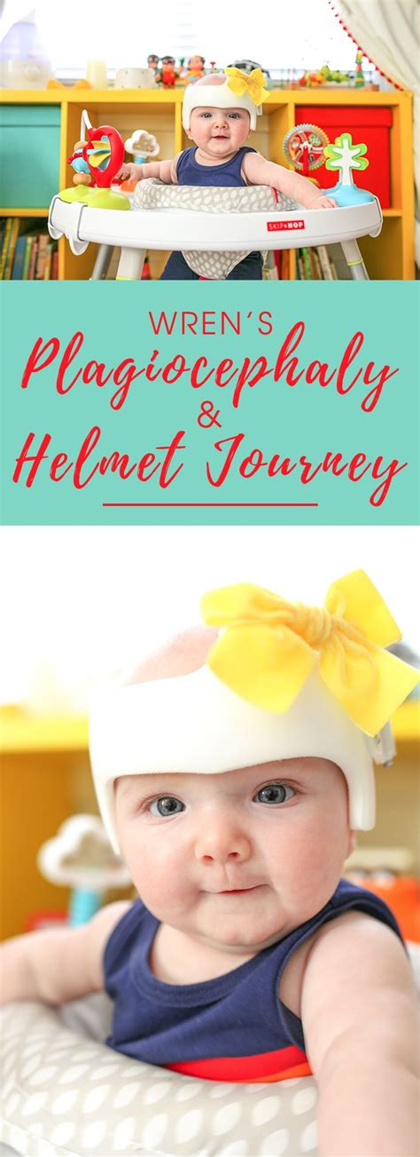 Wrens Plagiocephaly And Helmet Journey Including Some Advice And Faqs