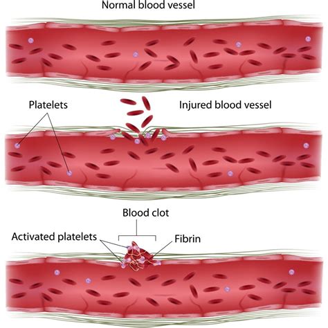 Flow Chart Blood Clotting Process Diagram