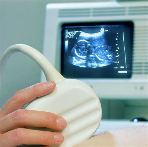 Ultrasound Scanning Of A Pregnant Woman Photograph By Saturn Stills
