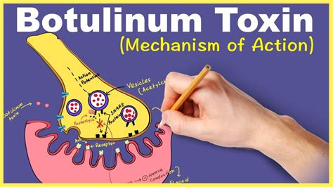 Botulinum Toxin Kaesthetics