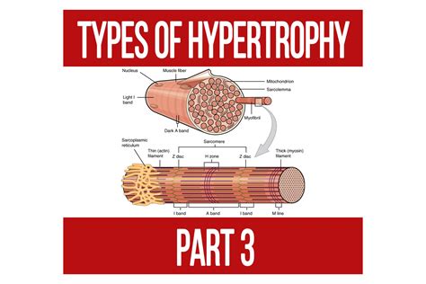 Types Of Hypertrophy Part 3 N1 Training