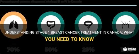 Understanding Stage 1 Breast Cancer Treatment In Canada What You Need